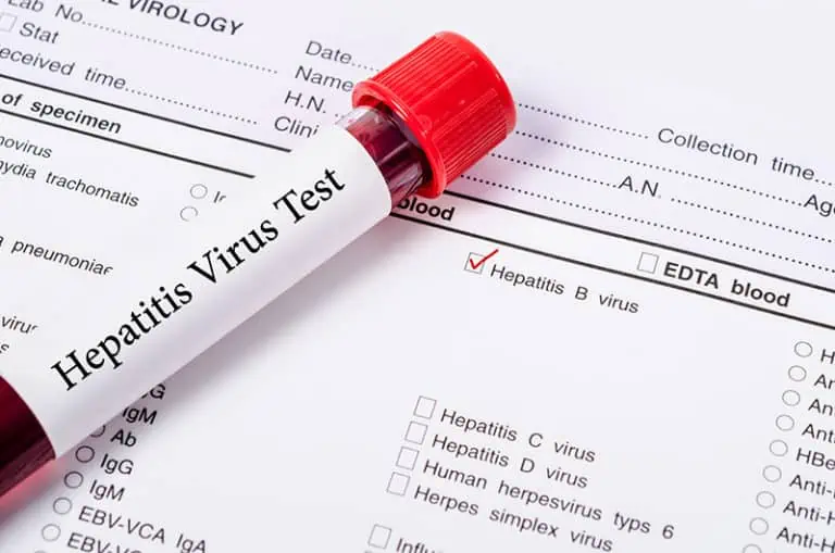 Тест за хепатит Б – не бива да се отлага