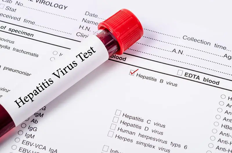 тест за хепатит Б